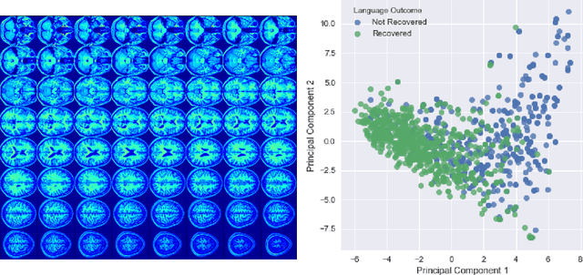 Figure 1 for Predicting Language Recovery after Stroke with Convolutional Networks on Stitched MRI