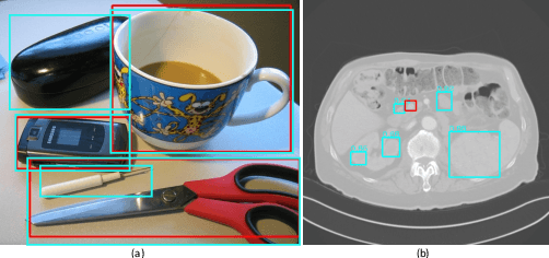 Figure 1 for ElixirNet: Relation-aware Network Architecture Adaptation for Medical Lesion Detection