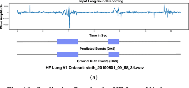 Figure 2 for Robust and Interpretable Temporal Convolution Network for Event Detection in Lung Sound Recordings