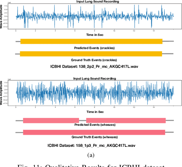 Figure 3 for Robust and Interpretable Temporal Convolution Network for Event Detection in Lung Sound Recordings