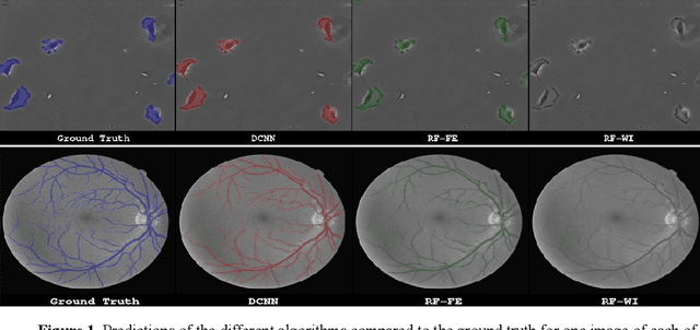Figure 2 for Assessing the Role of Random Forests in Medical Image Segmentation