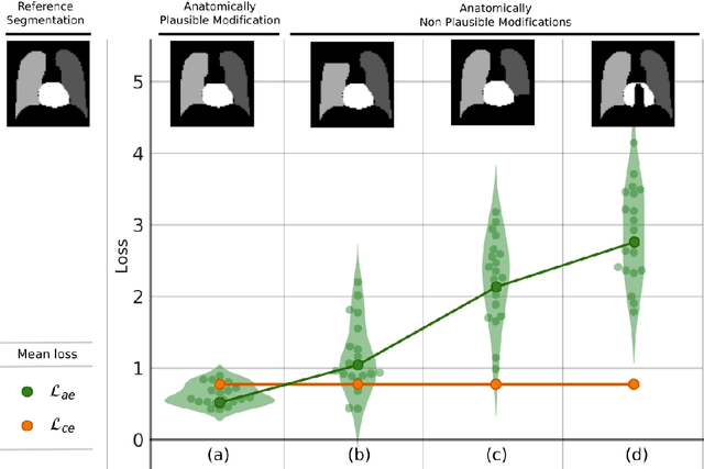 Figure 3 for Learning Deformable Registration of Medical Images with Anatomical Constraints