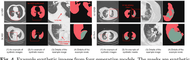 Figure 4 for CS$^2$: A Controllable and Simultaneous Synthesizer of Images and Annotations with Minimal Human Intervention
