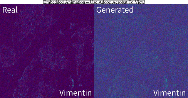Figure 3 for A SSIM Guided cGAN Architecture For Clinically Driven Generative Image Synthesis of Multiplexed Spatial Proteomics Channels