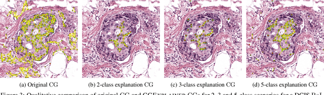 Figure 4 for Towards Explainable Graph Representations in Digital Pathology