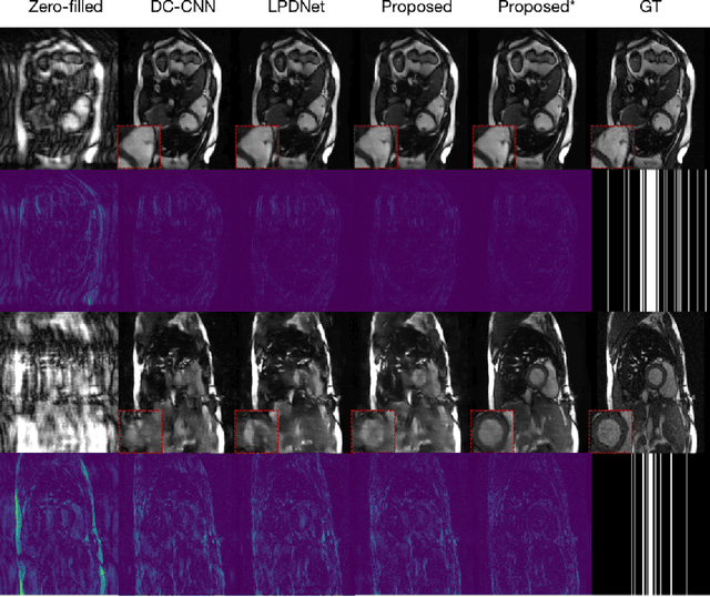 Figure 3 for Learned Half-Quadratic Splitting Network for Magnetic Resonance Image Reconstruction