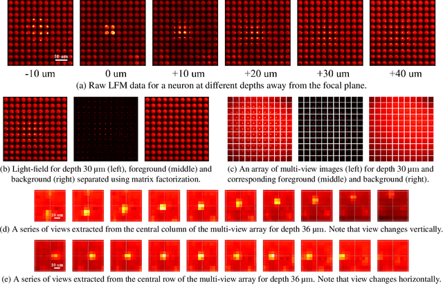Figure 3 for Light-Field Microscopy for optical imaging of neuronal activity: when model-based methods meet data-driven approaches
