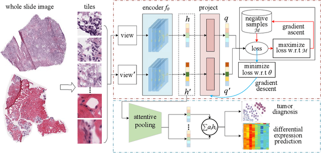 Figure 1 for Contrastive learning-based computational histopathology predict differential expression of cancer driver genes