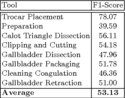 Figure 3 for Tool and Phase recognition using contextual CNN features
