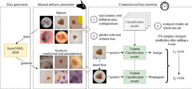 Figure 1 for The biasing effect of GAN-based augmentation methods on skin lesion images