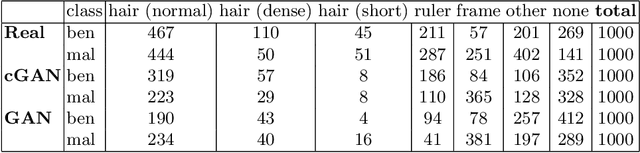 Figure 2 for The biasing effect of GAN-based augmentation methods on skin lesion images