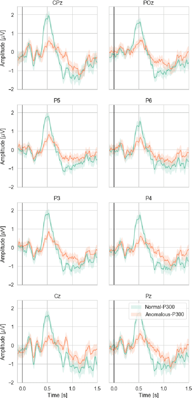 Figure 1 for Brain correlates of task-load and dementia elucidation with tensor machine learning using oddball BCI paradigm