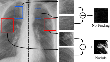 Figure 1 for Learning Visual Context by Comparison