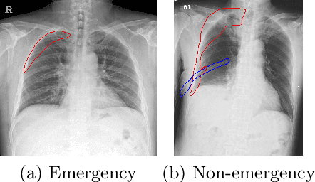 Figure 4 for Learning Visual Context by Comparison