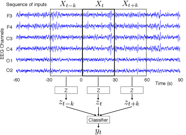 Figure 3 for A deep learning architecture for temporal sleep stage classification using multivariate and multimodal time series