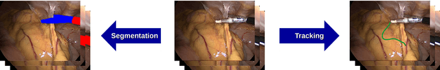 Figure 1 for Comparative evaluation of instrument segmentation and tracking methods in minimally invasive surgery