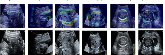 Figure 1 for Cognitive Explainers of Graph Neural Networks Based on Medical Concepts