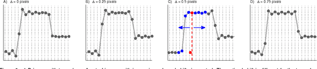 Figure 2 for Gibbs-Ringing Artifact Removal Based on Local Subvoxel-shifts