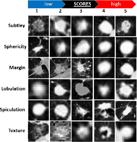 Figure 1 for Encoding High-Level Visual Attributes in Capsules for Explainable Medical Diagnoses