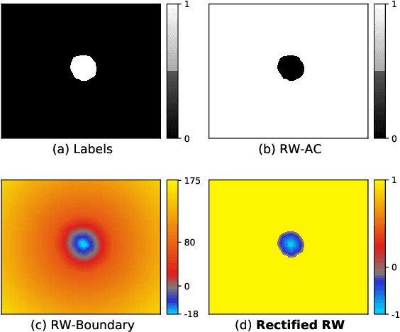 Figure 1 for Region-wise Loss for Biomedical Image Segmentation