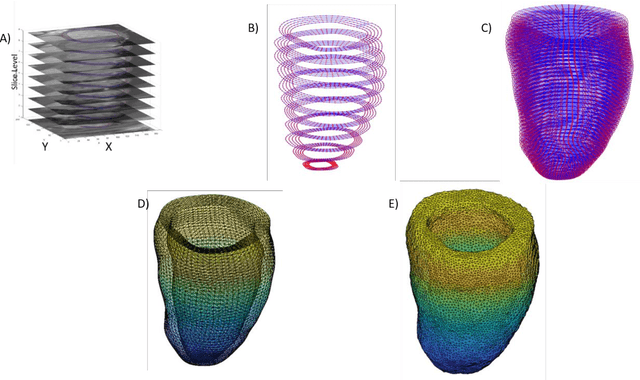 Figure 2 for Enhanced 3D Myocardial Strain Estimation from Multi-View 2D CMR Imaging