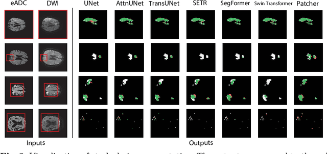 Figure 4 for Patcher: Patch Transformers with Mixture of Experts for Precise Medical Image Segmentation