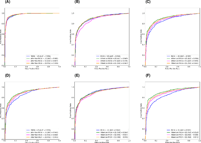 Figure 4 for Dual-Sampling Attention Network for Diagnosis of COVID-19 from Community Acquired Pneumonia
