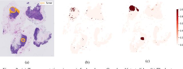 Figure 4 for Self-Supervision Closes the Gap Between Weak and Strong Supervision in Histology