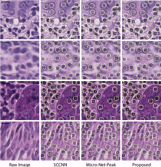 Figure 4 for Deconvolving convolution neural network for cell detection