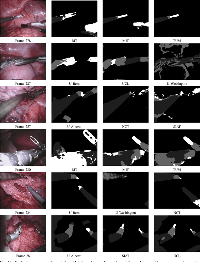 Figure 3 for 2017 Robotic Instrument Segmentation Challenge