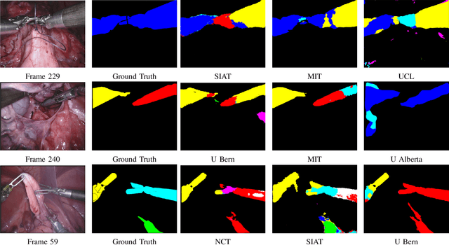 Figure 4 for 2017 Robotic Instrument Segmentation Challenge