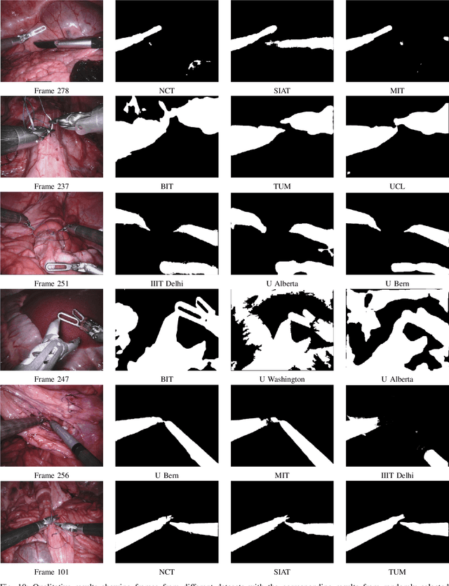 Figure 2 for 2017 Robotic Instrument Segmentation Challenge