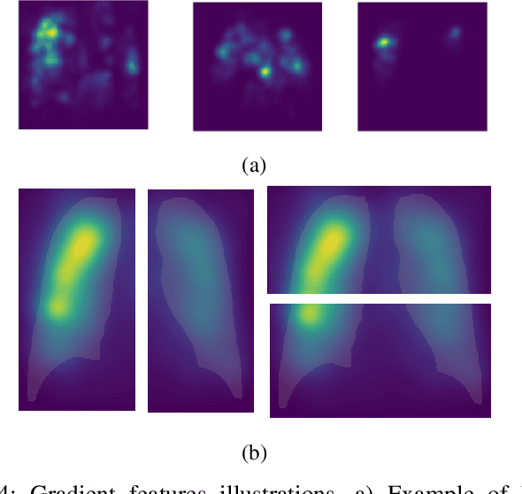 Figure 4 for Potential Features of ICU Admission in X-ray Images of COVID-19 Patients