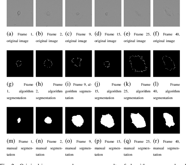 Figure 2 for Automated image segmentation for detecting cell spreading for metastasizing assessments of cancer development