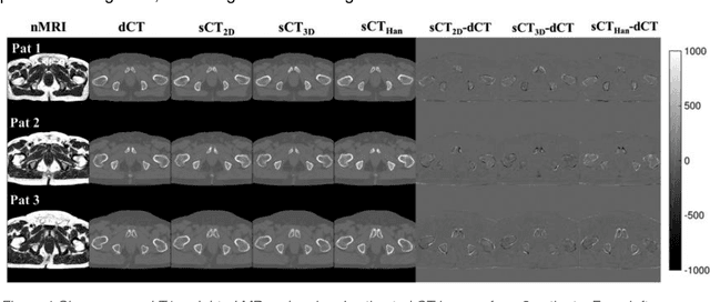 Figure 2 for CNNs and GANs in MRI-based cross-modality medical image estimation