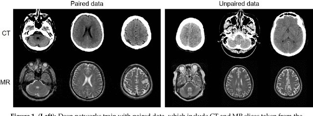 Figure 1 for Deep CT to MR Synthesis using Paired and Unpaired Data