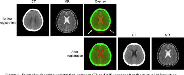 Figure 3 for Deep CT to MR Synthesis using Paired and Unpaired Data