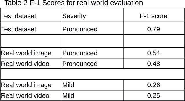 Figure 3 for Assessing a mobile-based deep learning model for plant disease surveillance