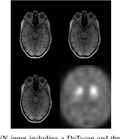 Figure 3 for A Unified Deep Learning Approach for Prediction of Parkinson's Disease