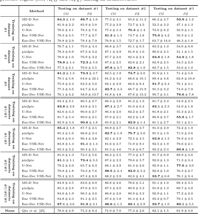 Figure 2 for USE-Net: incorporating Squeeze-and-Excitation blocks into U-Net for prostate zonal segmentation of multi-institutional MRI datasets