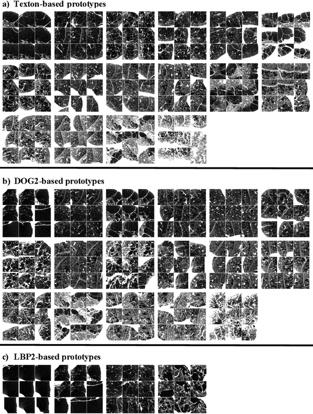 Figure 4 for Explaining Radiological Emphysema Subtypes with Unsupervised Texture Prototypes: MESA COPD Study