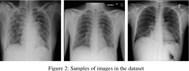 Figure 3 for Automated detection of COVID-19 cases from chest X-ray images using deep neural network and XGBoost