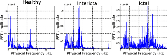 Figure 2 for A New Approach to Automated Epileptic Diagnosis Using EEG and Probabilistic Neural Network