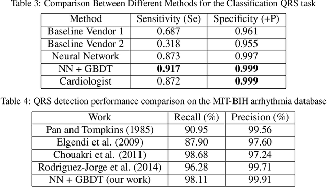 Figure 4 for Noise-Resilient Automatic Interpretation of Holter ECG Recordings