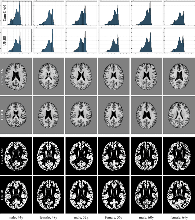 Figure 1 for Machine Learning with Multi-Site Imaging Data: An Empirical Study on the Impact of Scanner Effects
