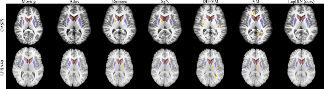 Figure 3 for Large Deformation Diffeomorphic Image Registration with Laplacian Pyramid Networks