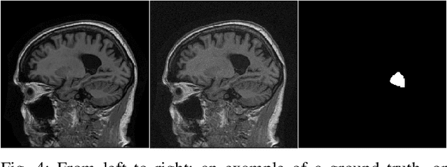 Figure 4 for Learning stochastic object models from medical imaging measurements by use of advanced AmbientGANs