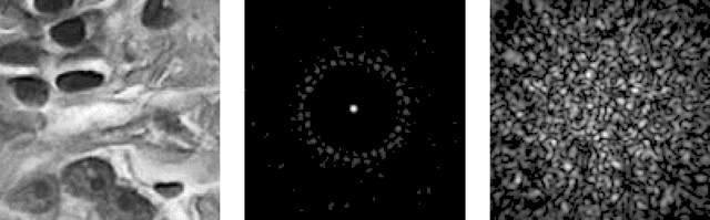 Figure 2 for Compressive Sampling Approach for Image Acquisition with Lensless Endoscope