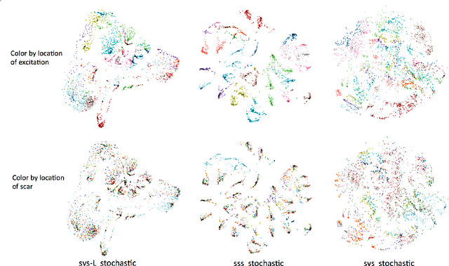 Figure 4 for Improving Generalization of Sequence Encoder-Decoder Networks for Inverse Imaging of Cardiac Transmembrane Potential
