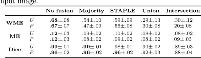 Figure 2 for On the Effect of Inter-observer Variability for a Reliable Estimation of Uncertainty of Medical Image Segmentation